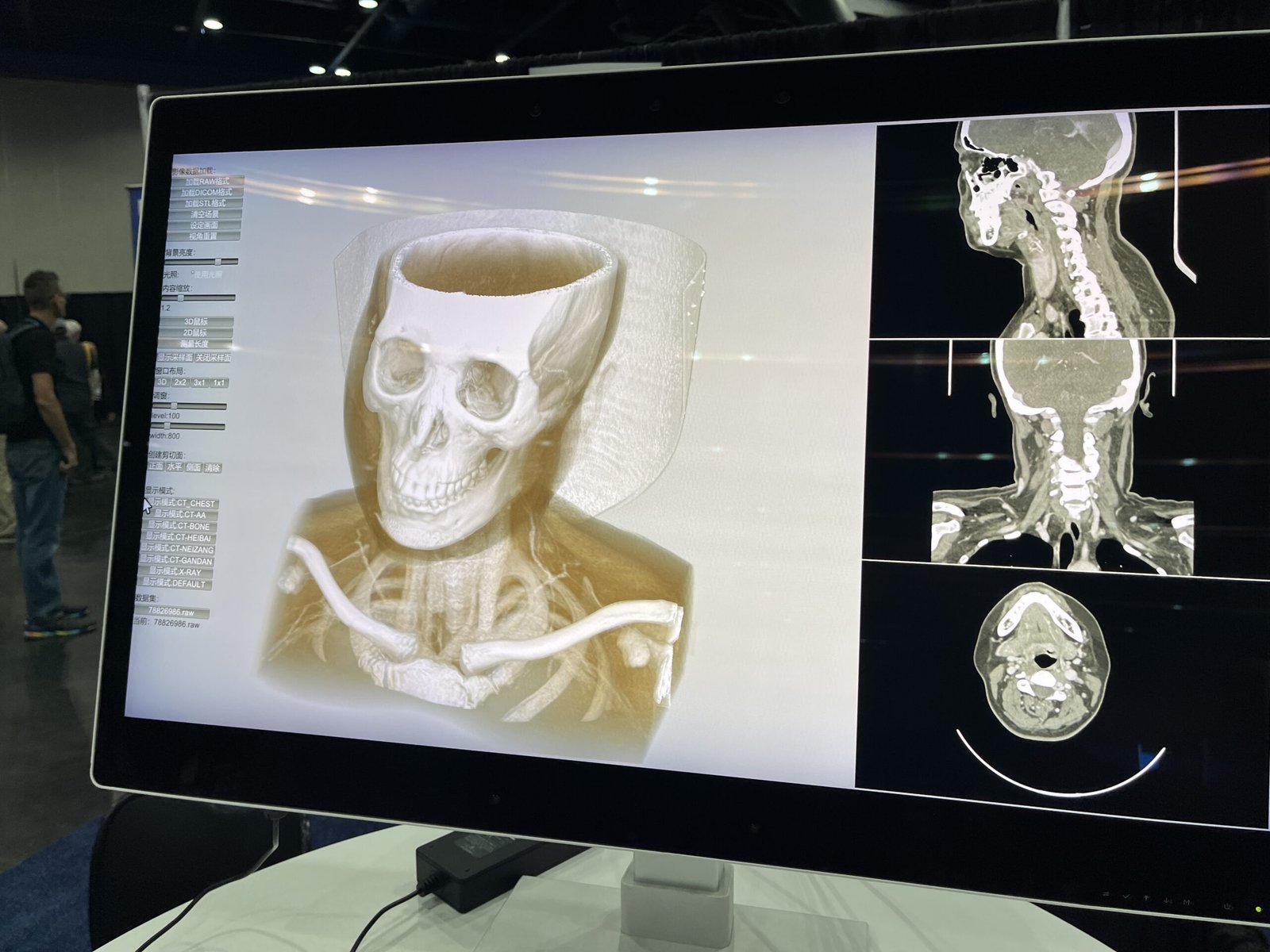 BOE’s 3D display at 3DExperience World 2026. (Image: Author.)
